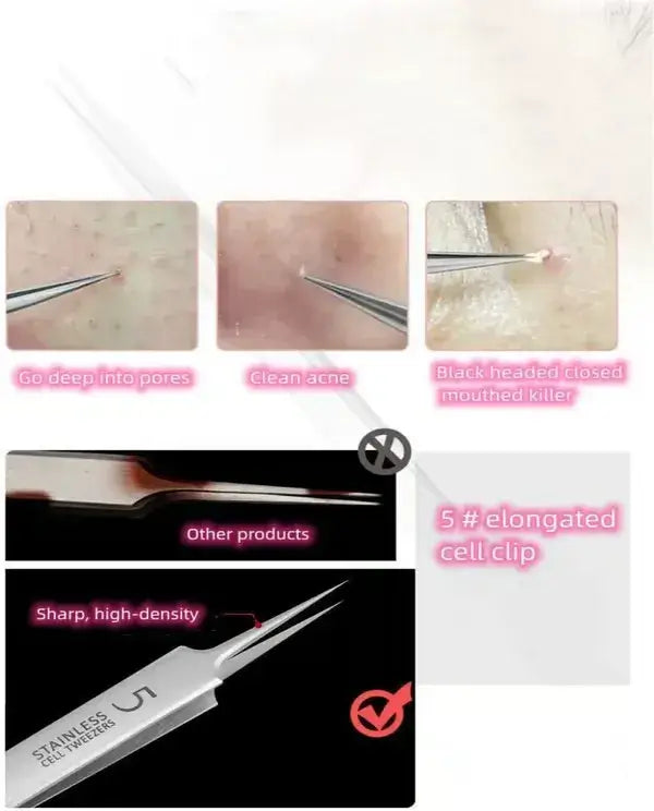 Professional Facial Blackhead Remover Tweezers